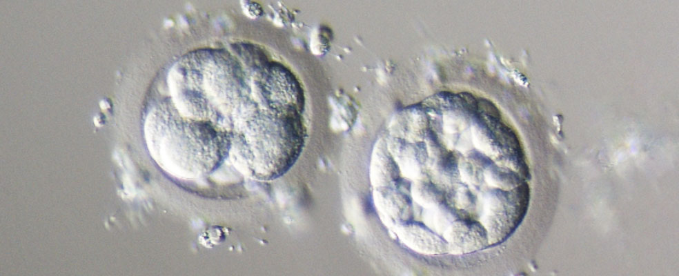 Two-Stage Embryo Transfer Technique